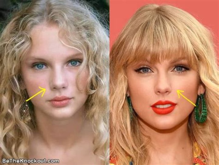 Did Taylor Swift Get A Nose Job? Face Before And After Plastic Surgery!