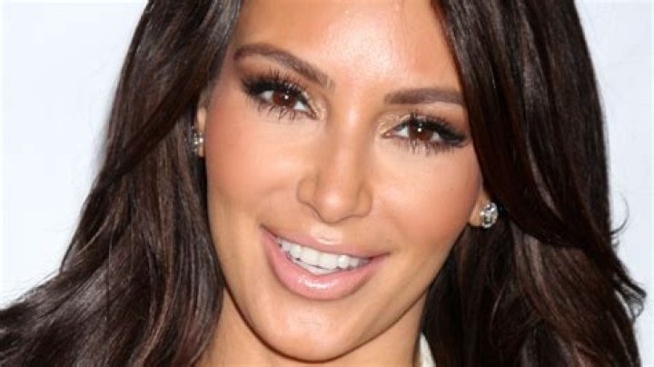 Does Kim Kardashian Have Veneers?