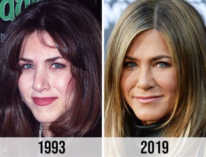 Has Jennifer Aniston Had Plastic Surgery?