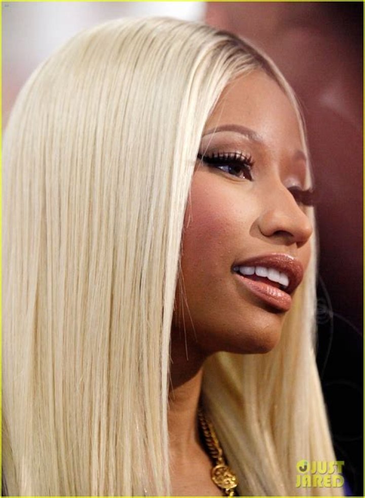 Nicki Minaj’s Has Yellow Teeth On Inner Side Of Her Mouth